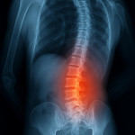 Low Back Pain Photo.jpeg