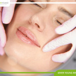Lip Enhancement Wellington FL 05.jpg