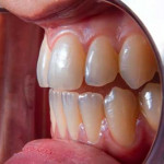 white-teeth-2.jpgCosmetic Dentist In Galleria and Uptown Areas of Houston, Texas