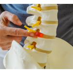 Spinal Decompression Omaha Nebraska.png