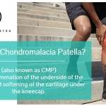 Blog-04__02-Doctors-of-Osteo-Chondromalacia-Patella.jpg