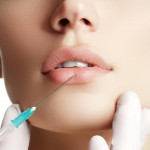 Arcadia Wellness Center Lip Injections.jpg
