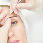 Olympia Aesthetics - Blog photo (4).png