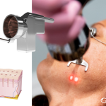 Olympia Aesthetics - Blog photo.png