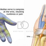 Doctors-of-Osteo-Carpal-Tunnel-Syndrome.jpg