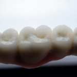 four-implants-scaled.jpg