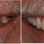 before-after.png