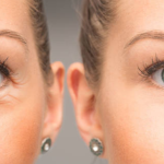 Olympia Aesthetics - Blog photo (1).png