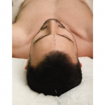 acupuncture for headaches-komp chiropractic and acupuncture-omaha nebraska.png