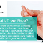 Blog-14__02-Doctors-of-Osteo-Trigger-Finger.jpg