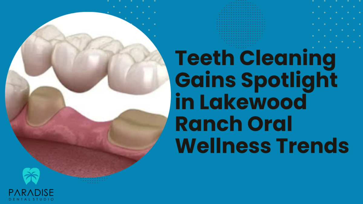 Crown Confidence: Fort Lauderdale Patients Choosing Shade-Matched Precision