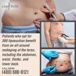 Ciao Bella Cosmetic Surgery (Chandler) 6 (ver 1) (1).jpg