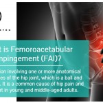 Blog-07__02-What is Femoroacetabular Impingement.jpg