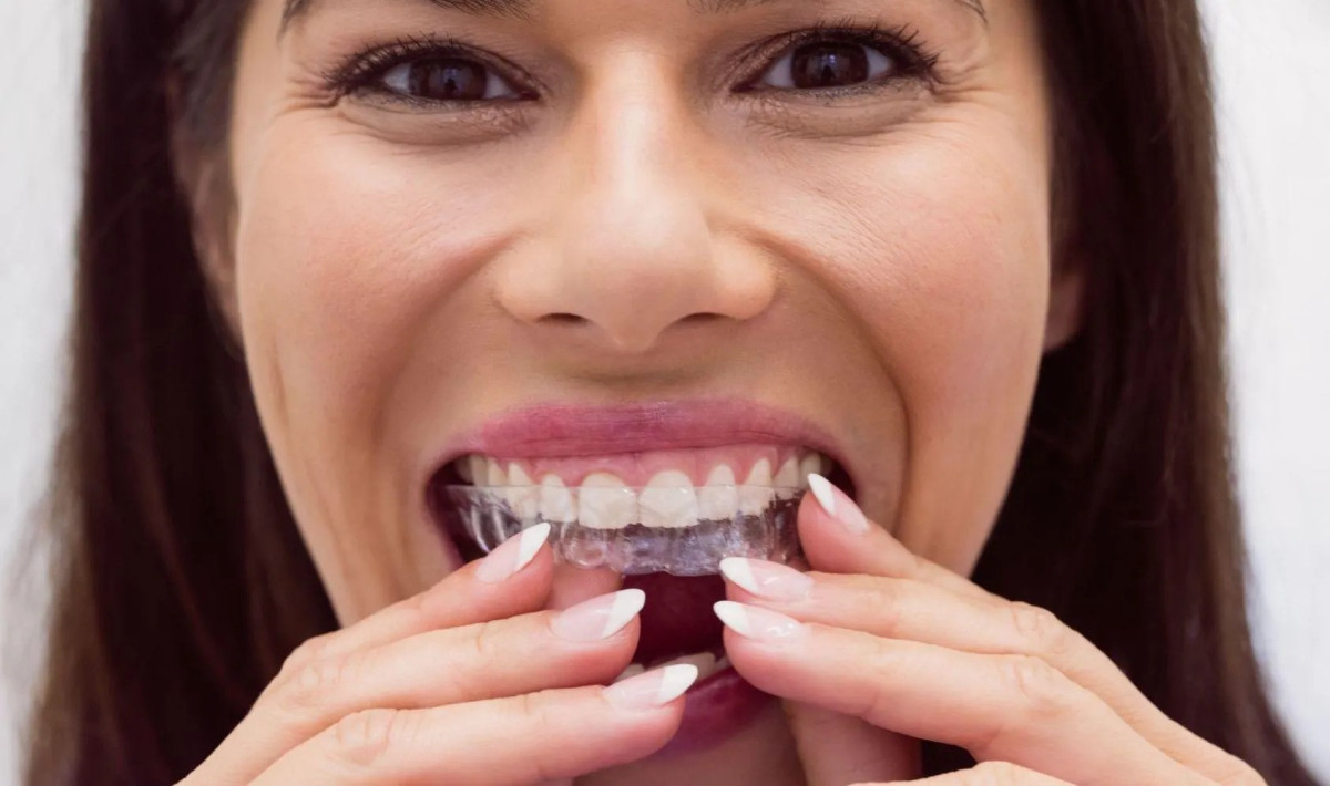 Discover the Best Orthodontist in Baton Rouge, LA