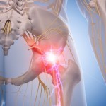 chiropractor millard nebraska.jpg