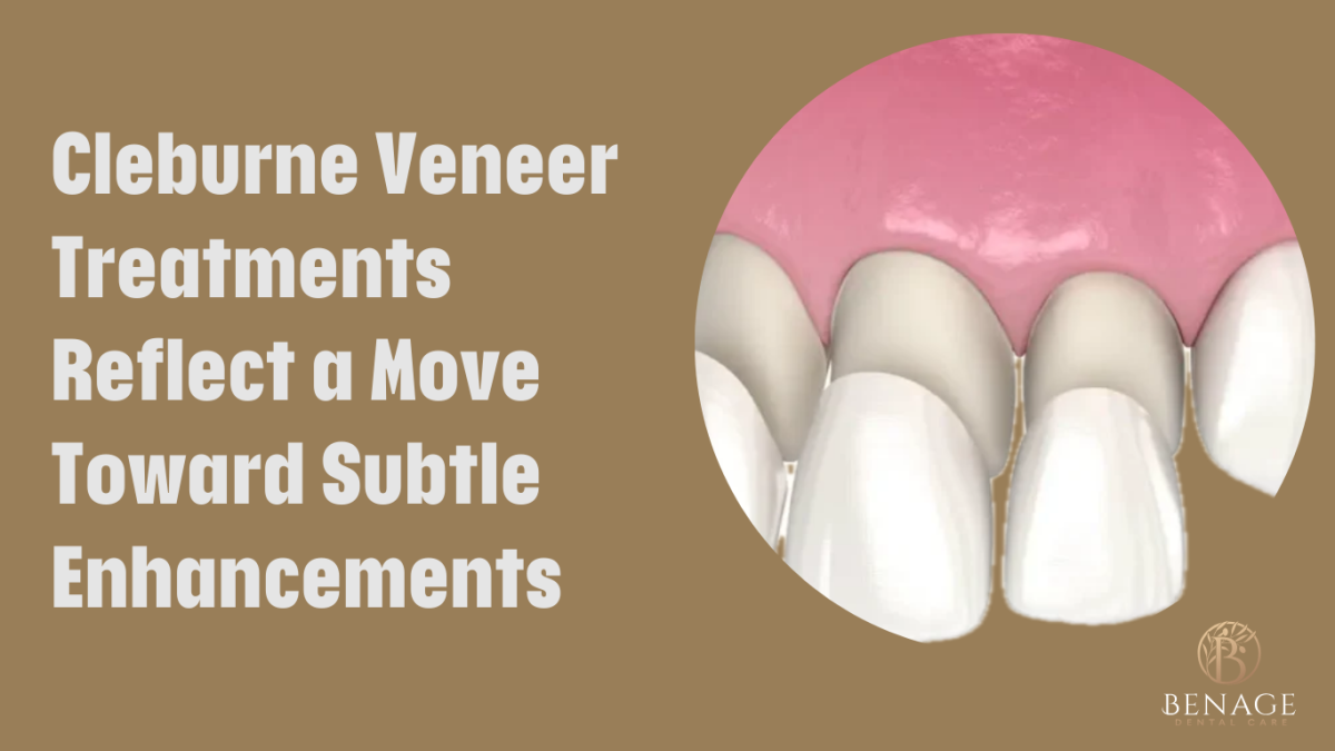 Cleburne Veneer Treatments Reflect a Move Toward Subtle Enhancements