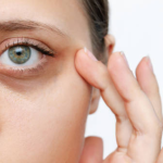Olympia Aesthetics - Blog photo.png