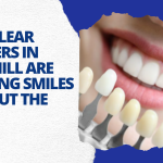 How Clear Aligners in Rock Hill are Creating Smiles Without the Wait