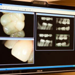 Dental Photos and X-rays