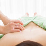acupuncture in omaha nebraska-komp chiropractic and acupuncture clinic.jpg