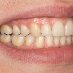 Gemini_Generated_Image_lq3d2elq3d2elq3d (2).jpeg