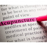 acupuncture near me-komp chiropractic and acupuncture.jpg