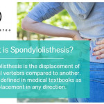 Blog-15__02-Spondylolisthesis.jpg